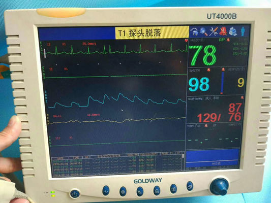 โกลด์เวย์ UT4000B ปรับปรุงจอรักษาพยาบาล